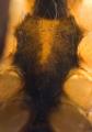 Sternum