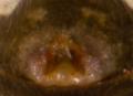 Epigyne des Weibchens