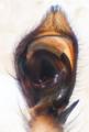Pedipalpus
