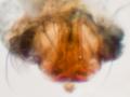 Epigyne des Weibchens